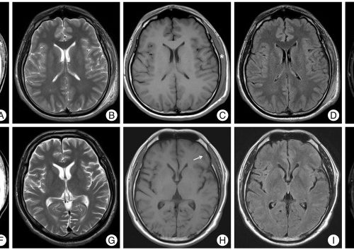 CT Scan & MRI