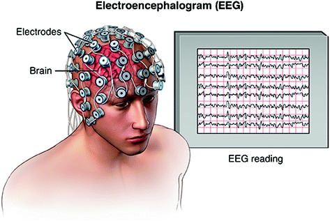 EEG (electroencephalogram)