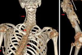3D Scan