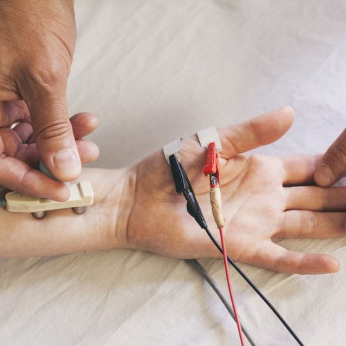 NCS / EMG  (Nerve conduction tests / Electromyography)