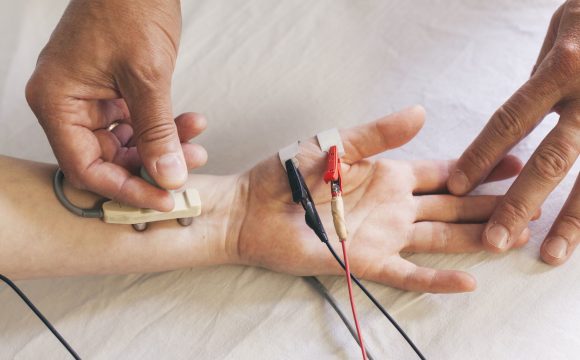 NCS / EMG  (Nerve conduction tests / Electromyography)